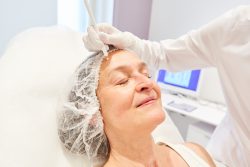Why Does a Deep Plane Facelift Cost More Than a Traditional Facelift?