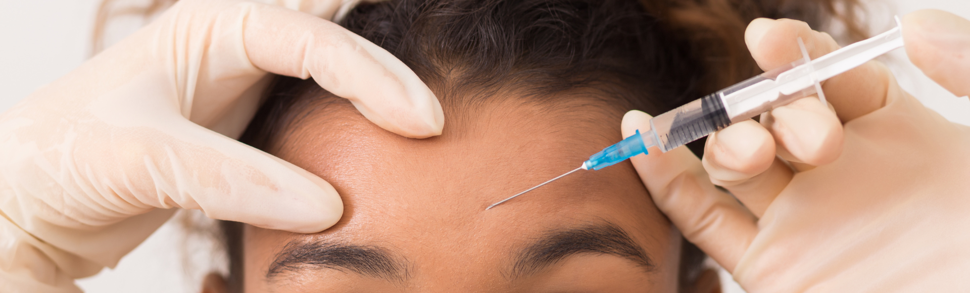 Botox for wrinkle prevention Bethesda MD