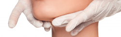 neck lift procedure Chevy Chase MD