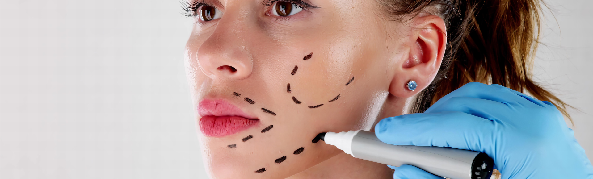 woman preparing for facelift surgery in Montgomery County