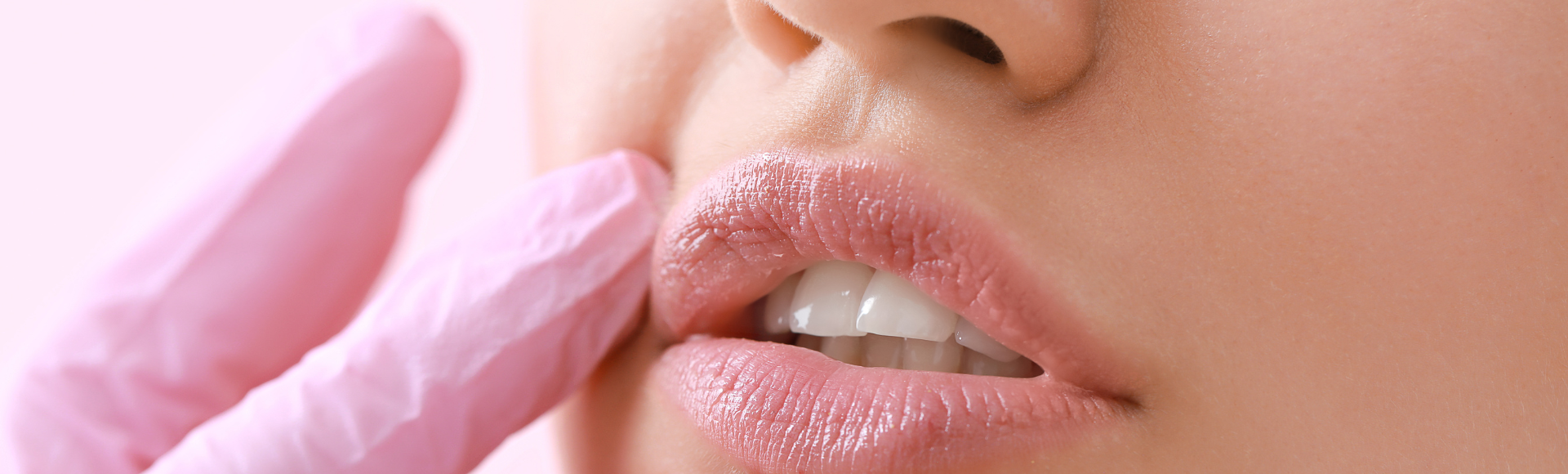 woman after lip lift surgery in Chevy Chase