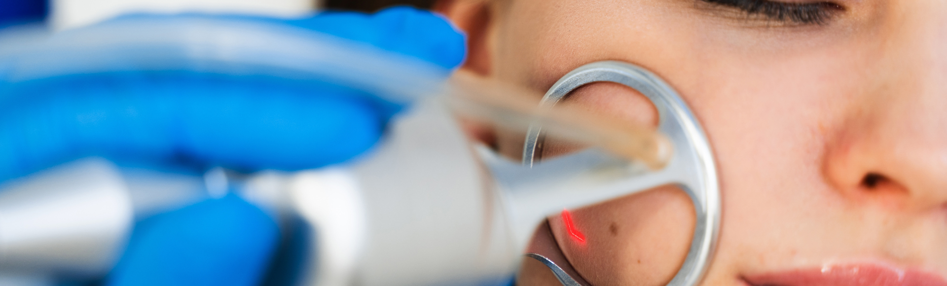 laser resurfacing NW DC