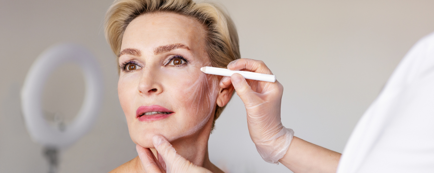 woman considering a deep plane facelift in DC