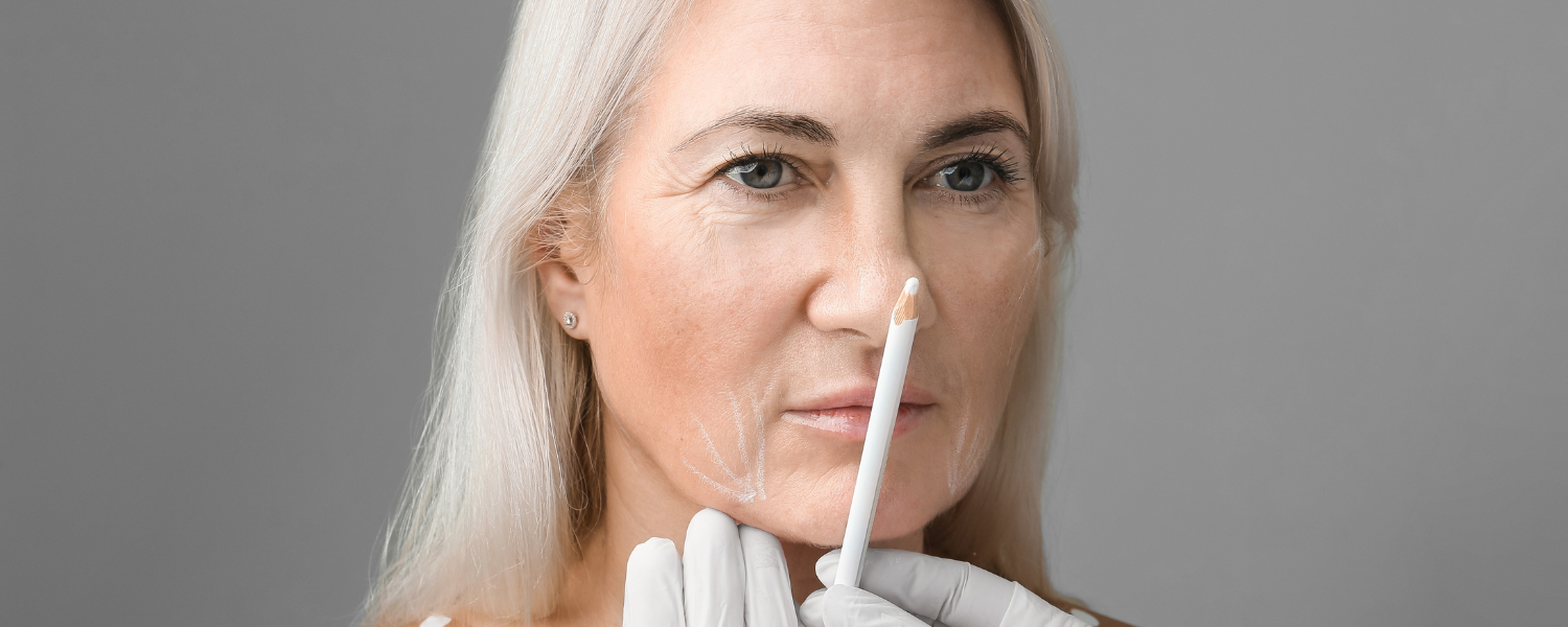 woman considering a deep plane facelift in Washington DC