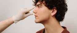 Dr. Singleton is the best facial plastic surgeon for teen rhinoplasties