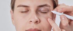 woman prepping for an upper blepharoplasty near NW Washington DC