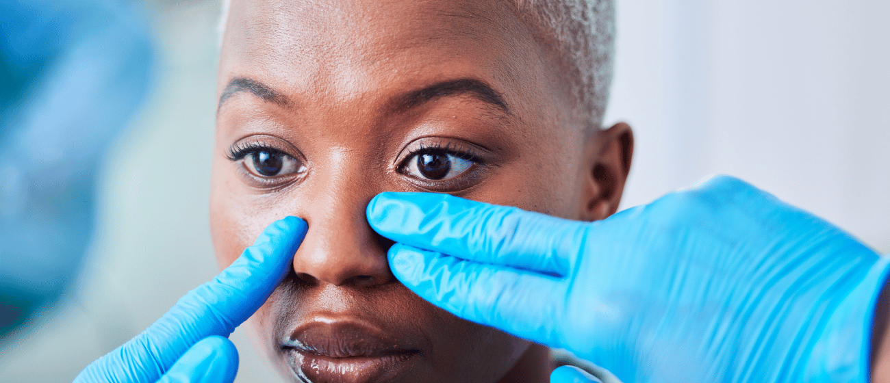 ethnic rhinoplasty in Washington DC